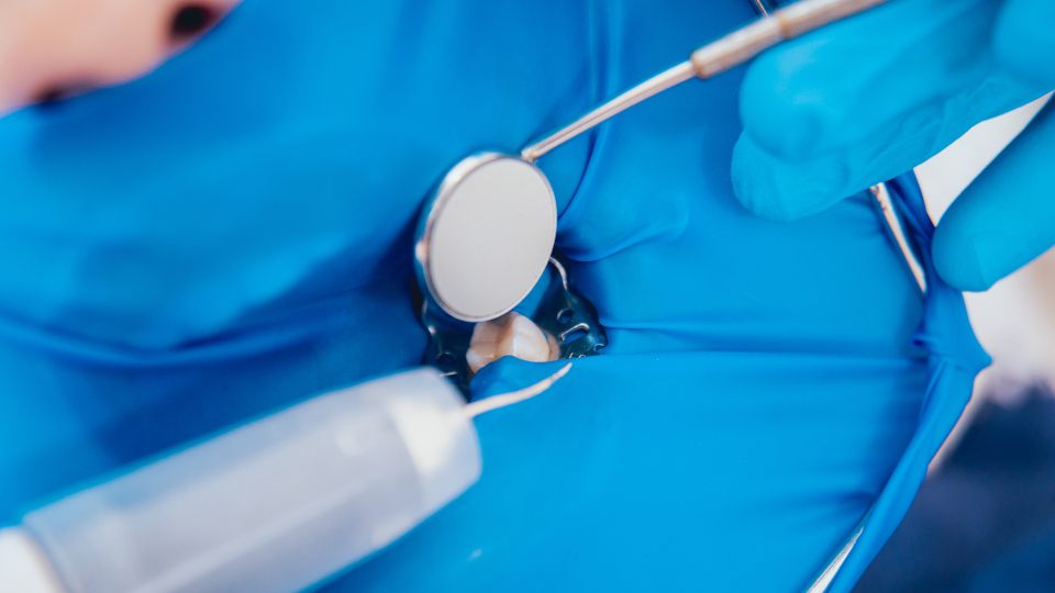 Eine Wurzebehandlung läuft nicht immer ohne Komplikationen. Hier erfahren Sie, wie Ihnen Ihr Zahnarzt im Fall der Fälle helfen kann. 
