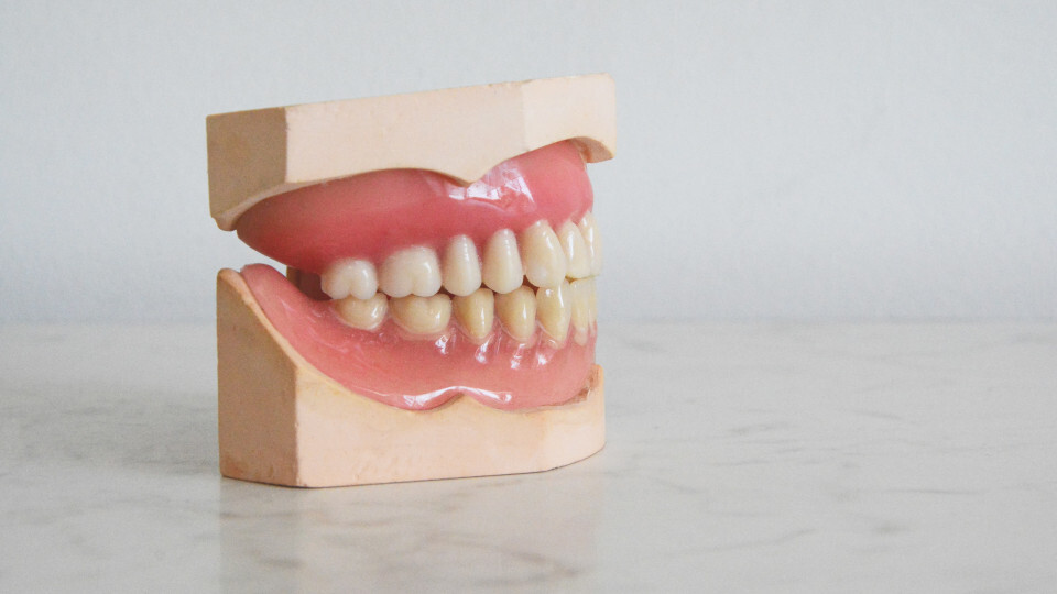 „CEREC“ – Keramische Zahnrekonstruktion: Funktionsweise und Ablauf