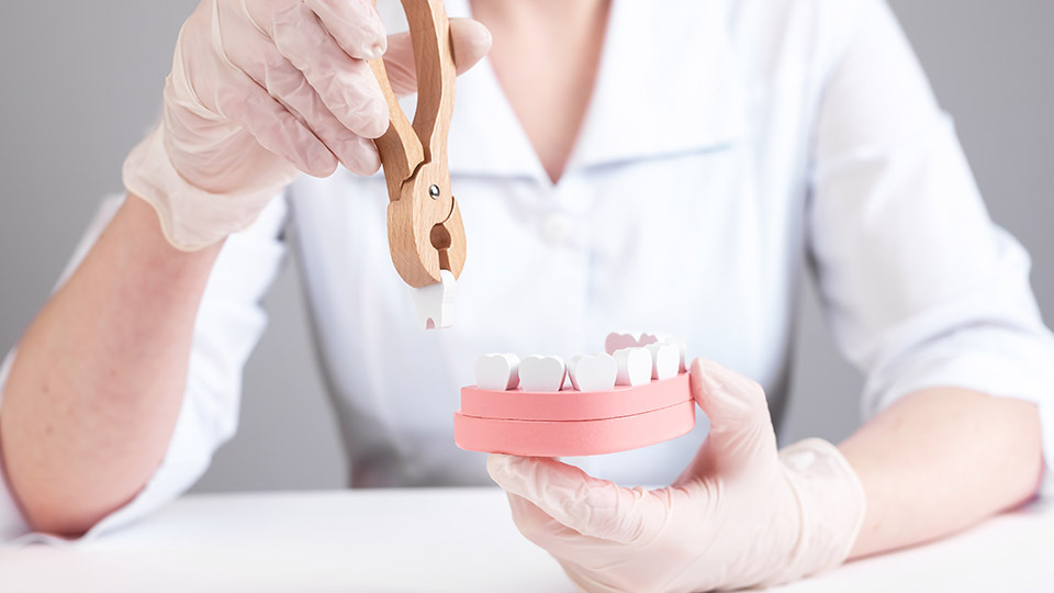 Zahnextraktion: Zahnärztin zieht Zahn aus einem Modell eines Kiefers