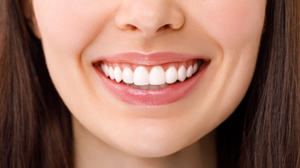 Eine lächlnde Frau mit Veneers